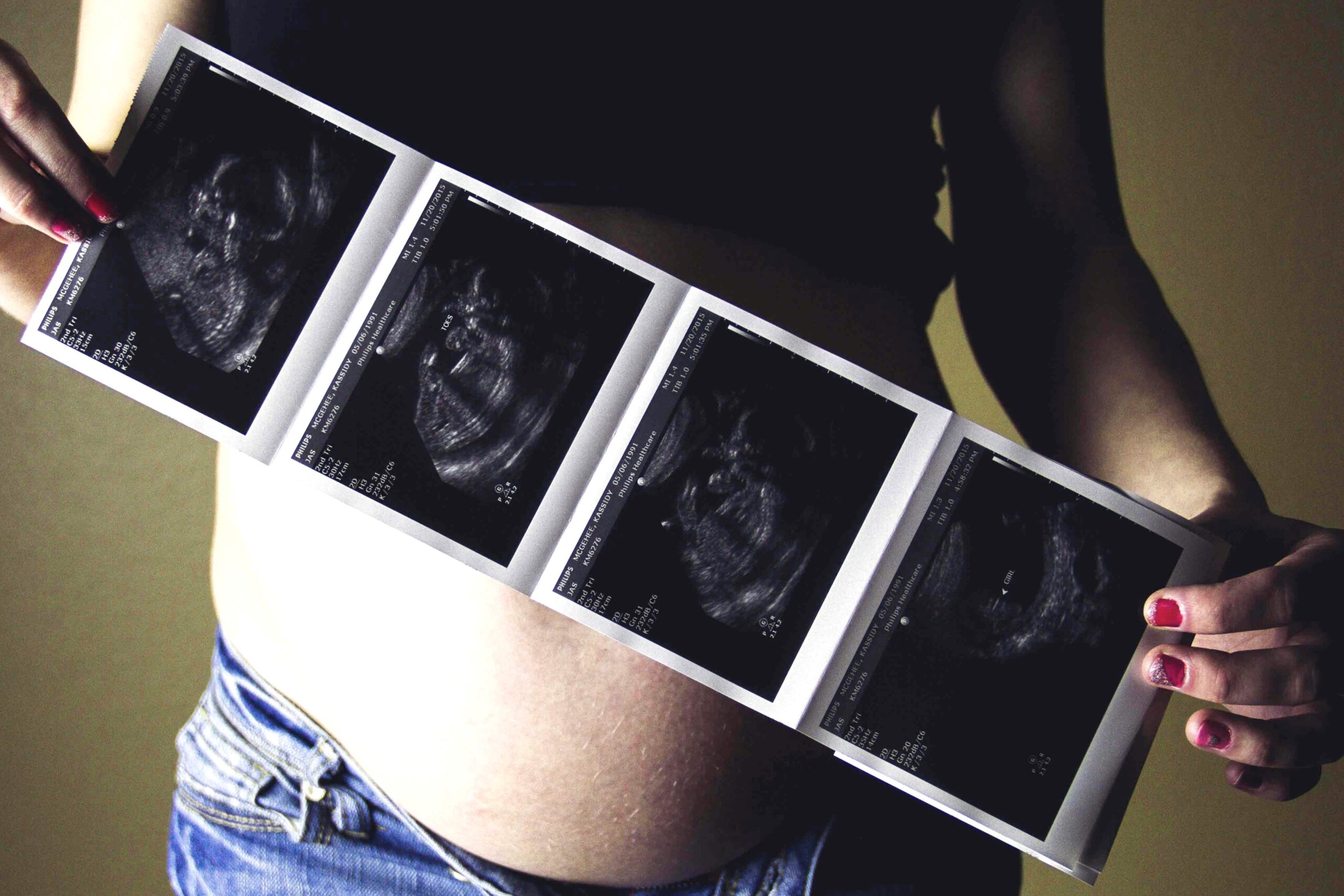 Frau zeigt Ultraschallbilder - Was sind die Rechte von Schwangeren am Arbeitsplatz?