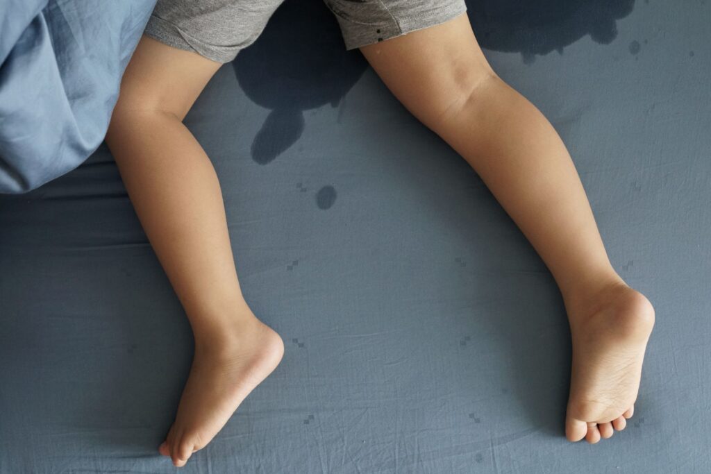 Kinderbeine und -füsse in nassem Bett. Bettnässen? Wie unser achtjähriges Kind nachts mit Hilfe eines Weckapparats trocken wurde.