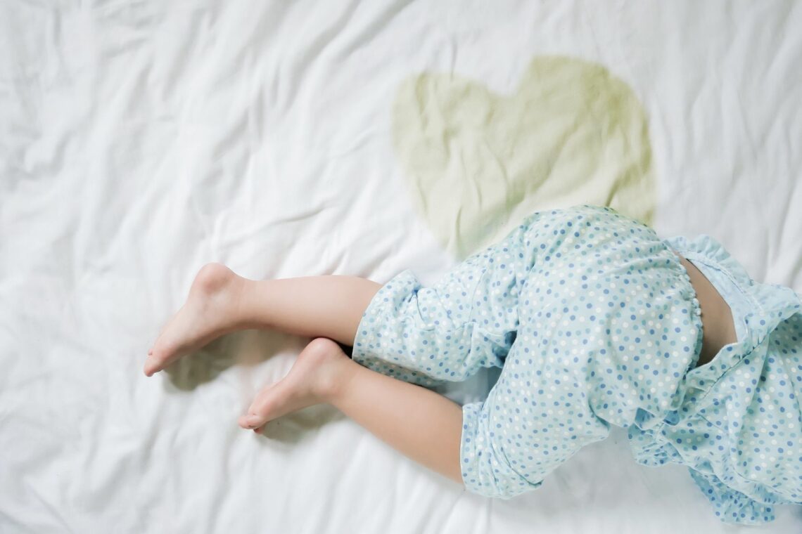 Kinderbeine auf weissem Leintuch, das einen gelben Fleck hat. – Was sind die Ursachen von Bettnässen und wie lässt es sich behandeln?