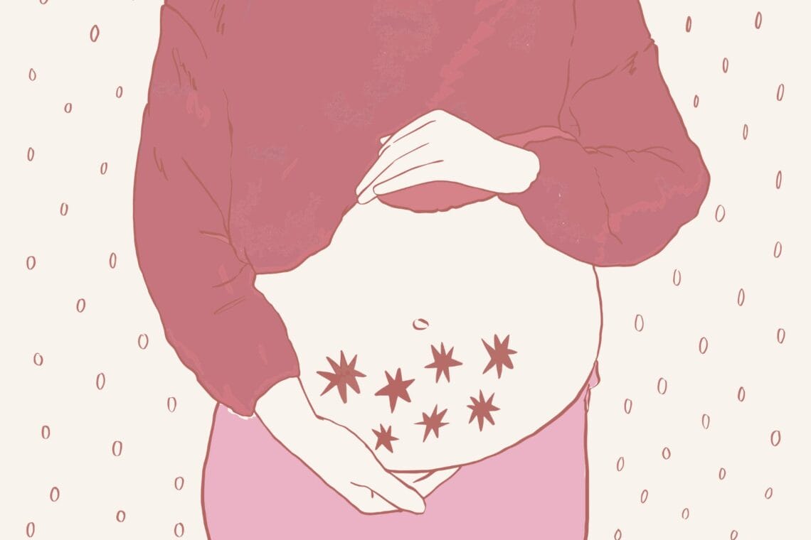Illustration eines schwangeren Bauches, darauf sind sieben Sterne abgebildet. - Selektive Abtreibung eines Zwillings, ein Erfahrungsbericht.