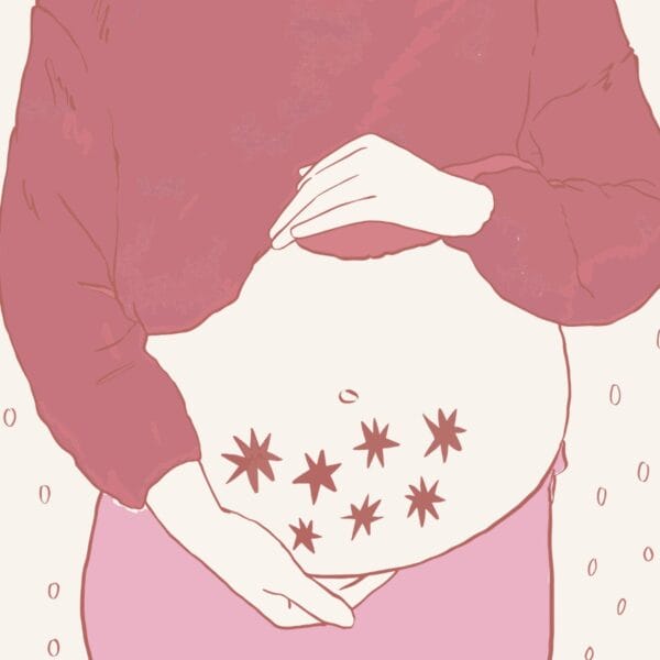 Illustration eines schwangeren Bauches, darauf sind sieben Sterne abgebildet. - Selektive Abtreibung eines Zwillings, ein Erfahrungsbericht.