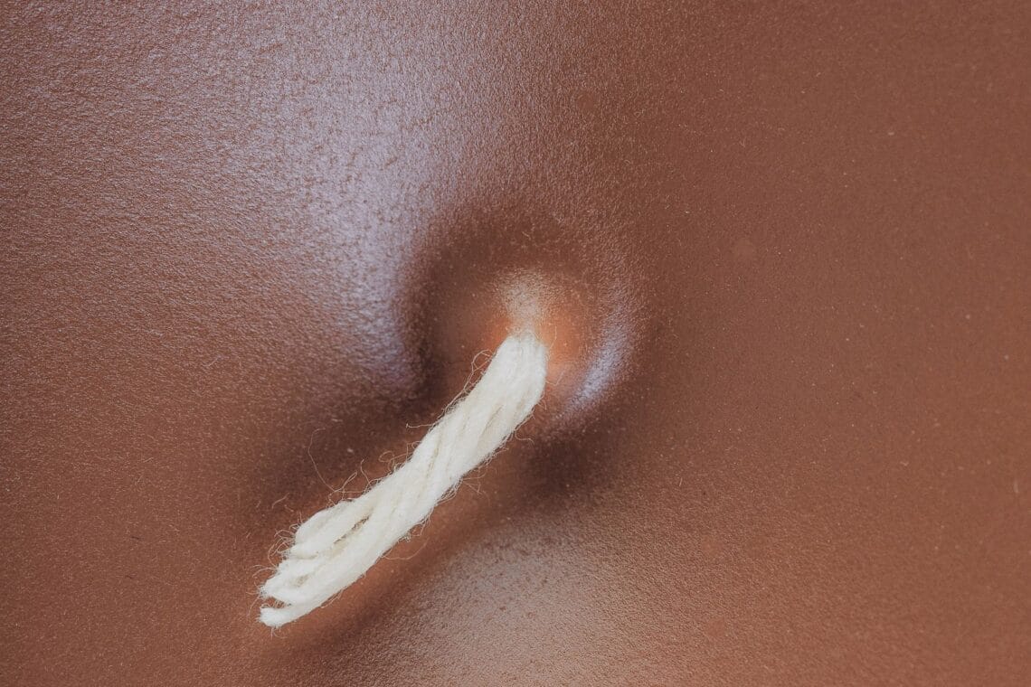 Nahaufnahme einer braunen Kerze mit Docht, die aussieht wie eine Brustwarze - Bad Hair(s) Day - wenn Haare plötzlich überall spriessen